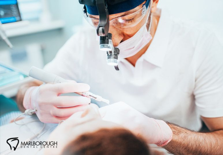 Calgary Root Canals: 5 Reasons Root Canals Save Your Tooth